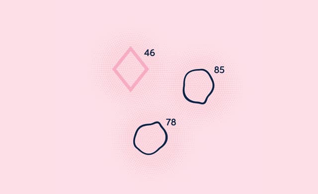 AI-breast-IMG-Detection aid AI-breast-IMG-Detection aid
