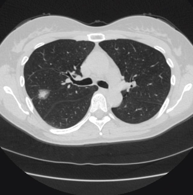 AI-lung-DetectOriginal AI-lung-DetectOriginal