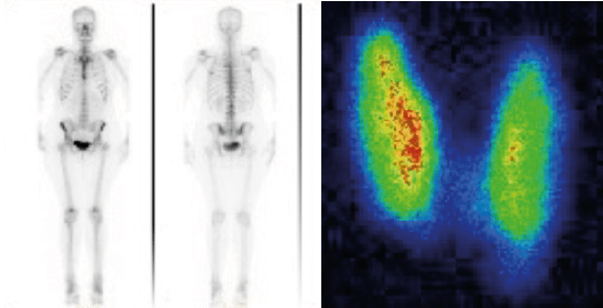 MI-Nuclear Medicine