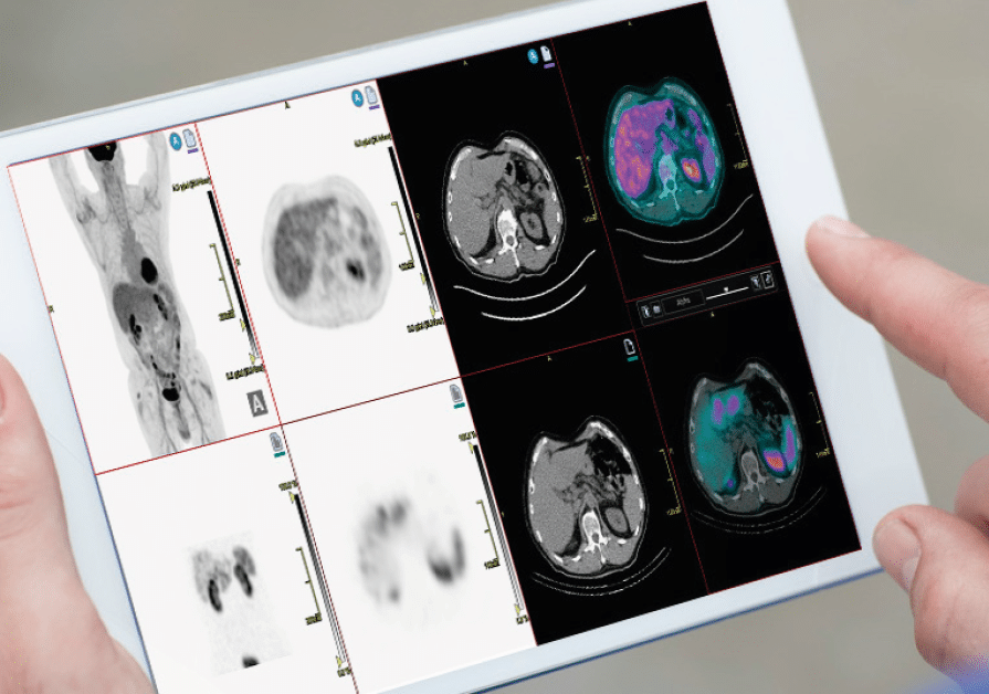 Molecular-Imaging-scan-ipad-web