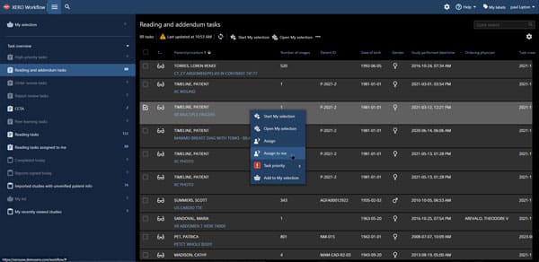 XERO-workflow-agfa XERO workflow also brings benefits to the radiologists