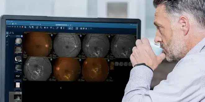 specialtyimaging-opthalmology