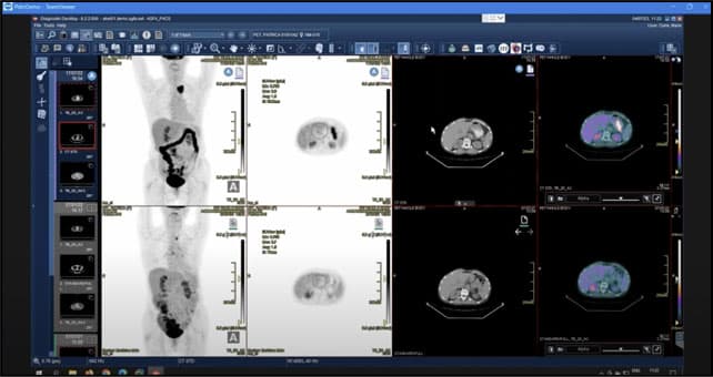 Enterprise Imaging for Molecular Imaging