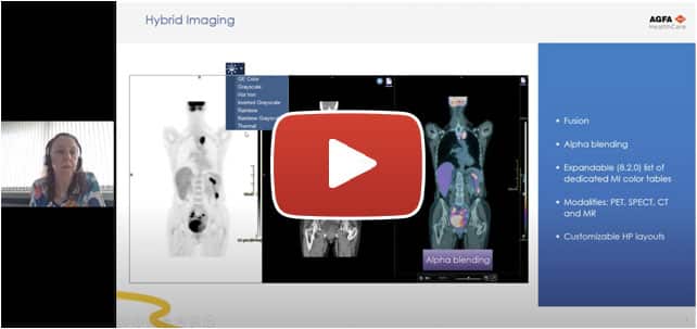 Watch On-demand Webinar: Enterprise Imaging for Molecular Imaging