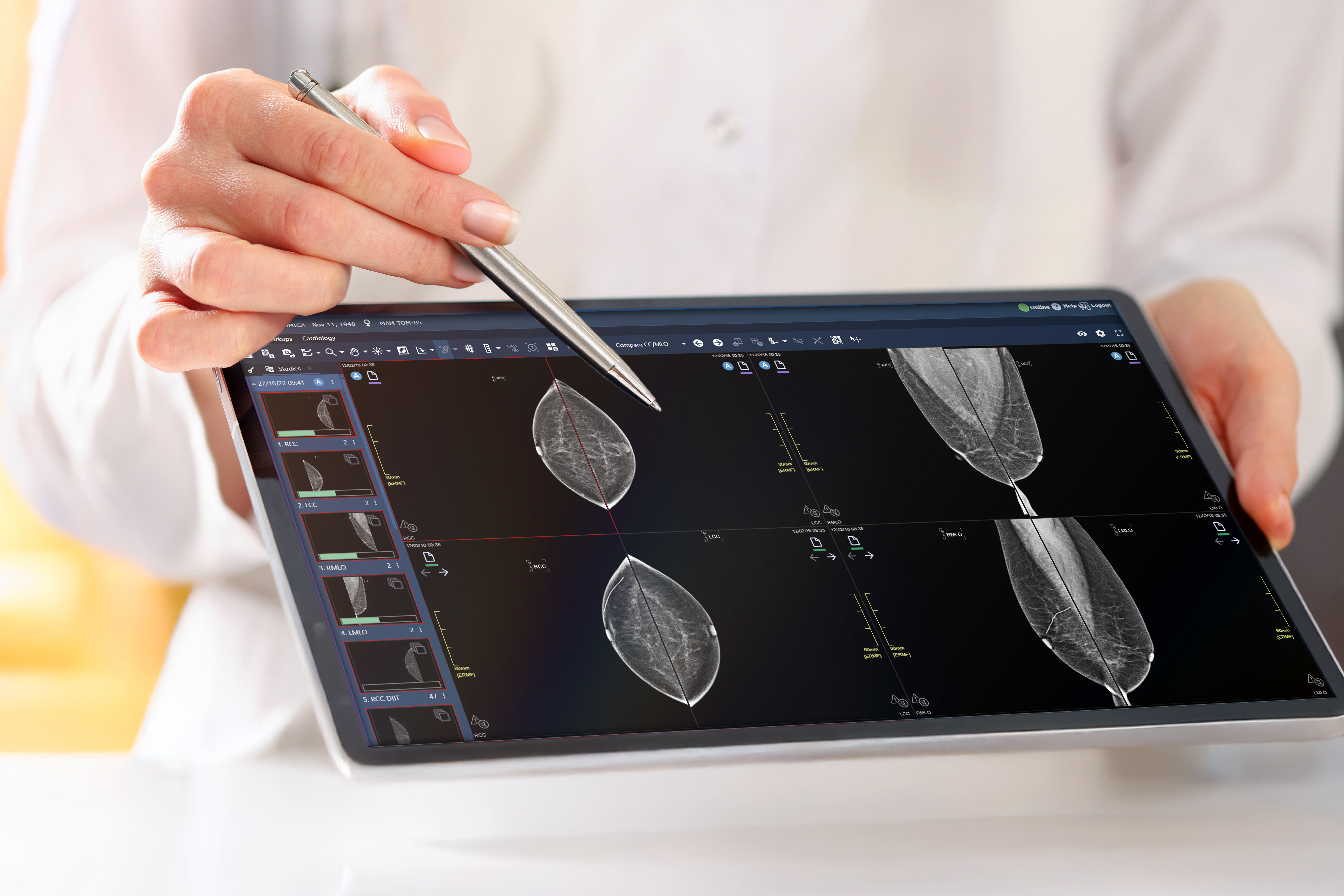 Mammography Hanging Protocols