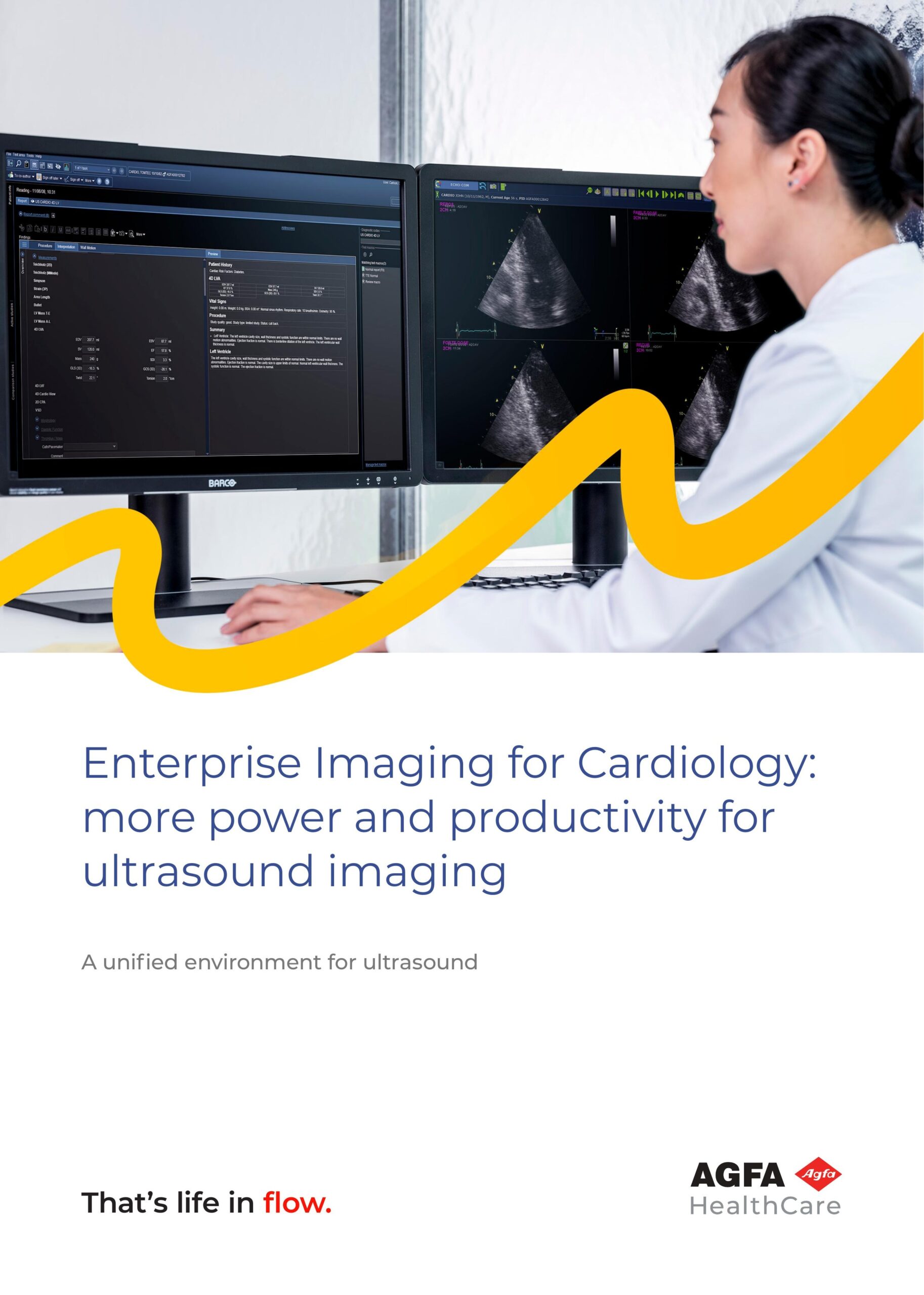 BROCHURE: AGFA HealthCare – Cardio Utrasound